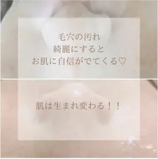 フェイシャル/毛穴 /シミ/神戸市東灘区のエステ・リラクイメージ