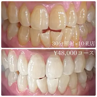 ホワイトニングルーム 横浜店のその他イメージ