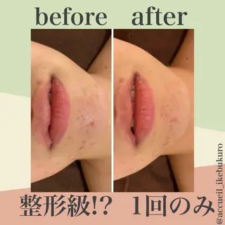 ミディアム カラー パーマ ヘアアレンジ メンズ キッズ ネイル マツエク・マツパ ニキビ・肌質改善専門 ♡人生が変わるサロンのエステ・リラクイメージ