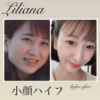 LILIANA ☆YURIのエステ・リラクイメージ