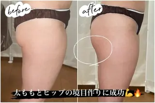 《本気痩せ×疲労改善 》  BILOOPのエステ・リラクイメージ