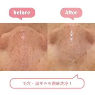 エステサロン BlooMeのエステ・リラクイメージ