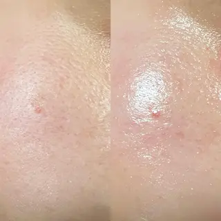 lymph care 'Welnəsのエステ・リラクイメージ
