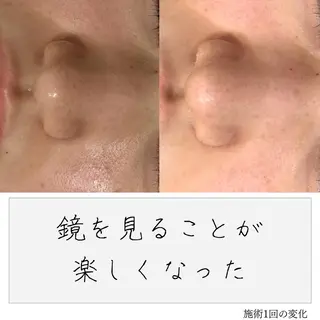 ニキビ経験者が施術 する専門サロン🌻のエステ・リラクイメージ