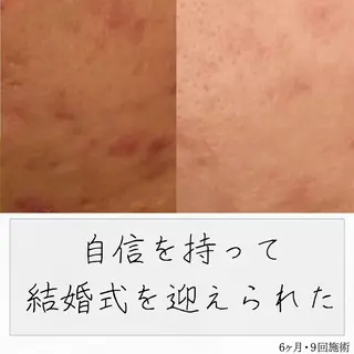 ニキビ経験者が施術 する専門サロン🌻のエステ・リラクイメージ