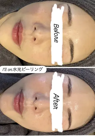 看護師 桐山 まどかのエステ・リラクイメージ