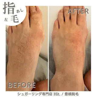 豊橋 |Hitomi シュガーリング専門店のその他イメージ