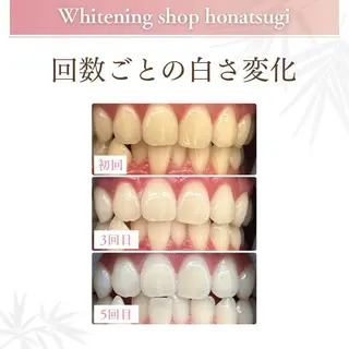 メンズ ホワイトニング ショップ本厚木のその他イメージ