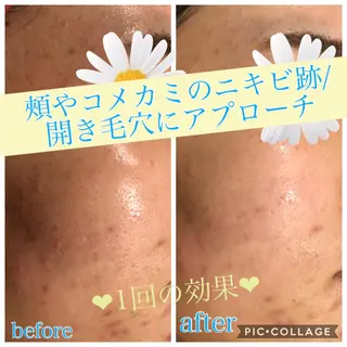 ショート カラー パーマ ヘアアレンジ キッズ ネイル マツエク・マツパ EnsorClair 代表 野口真央のエステ・リラクイメージ