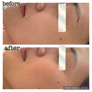 シミケア E Lashのエステ・リラクイメージ