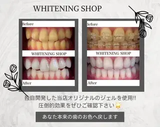 ホワイトニング ショップ船橋店のエステ・リラクイメージ