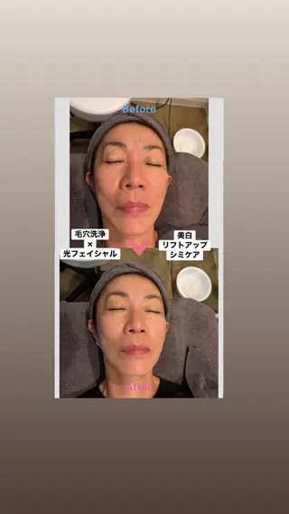 韓国肌管理 Mikiのエステ・リラクイメージ