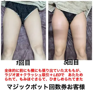 ネイル・エステサロン UILANIのエステ・リラクイメージ