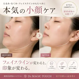 【歴13年】劇的小顔 D rマジックタッチのエステ・リラクイメージ