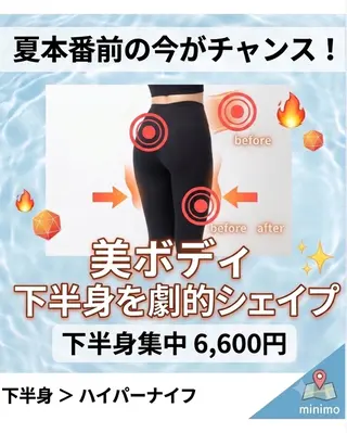 lucia豊明/前後 【肌管理・痩身】⁠のエステ・リラクイメージ