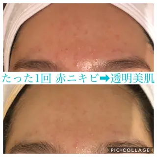 ミディアム カラー パーマ ヘアアレンジ キッズ ネイル マツエク・マツパ EnsorClair 代表 野口真央のエステ・リラクイメージ
