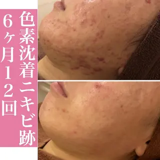 ミディアム カラー パーマ ヘアアレンジ メンズ キッズ ネイル マツエク・マツパ ニキビ・肌質改善専門 ♡人生が変わるサロンのエステ・リラクイメージ
