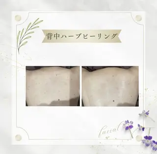 《 肌質×美肌 》 addissimoのエステ・リラクイメージ