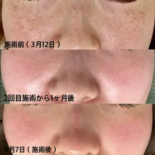 SKIN SKINのエステ・リラクイメージ