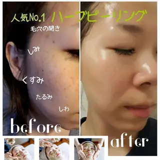 究極のアンチエイ ジングサロンのエステ・リラクイメージ