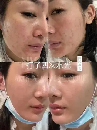 ネイル 愛維美水光専門店 川崎彩鳳のエステ・リラクイメージ