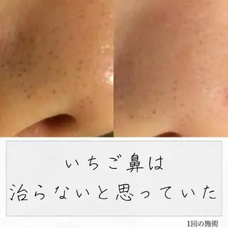 ニキビ経験者が施術 する専門サロン🌻のエステ・リラクイメージ