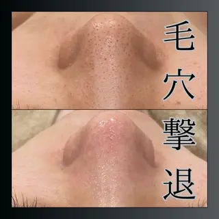 LiZA エステティックサロンのエステ・リラクイメージ