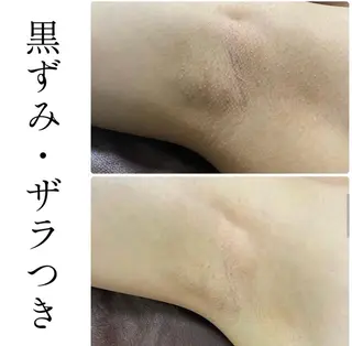 ハーブピーリング専門 BIOPLUS+川崎のエステ・リラクイメージ