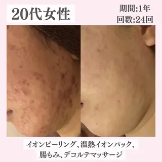 ニキビ・肌質改善専門 ♡人生が変わるサロンのエステ・リラクイメージ