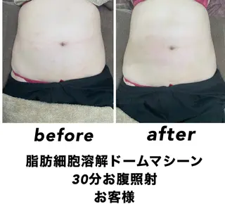 ネイル・エステサロン UILANIのエステ・リラクイメージ