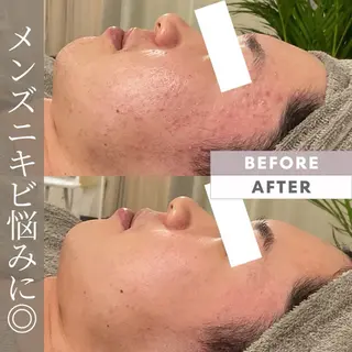 メンズ 美肌サロン💎ハーブ ピーリング🌿ルプレのエステ・リラクイメージ
