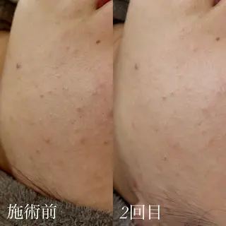 艶肌デトックス🫧 Samiraのエステ・リラクイメージ