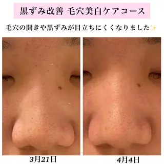 Bellesthe (ベルエステ)のエステ・リラクイメージ
