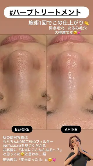 LiZA エステティックサロンのエステ・リラクイメージ
