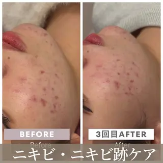 池田 桃花のエステ・リラクイメージ