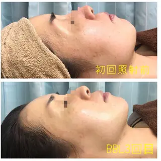 salon de epilaのエステ・リラクイメージ