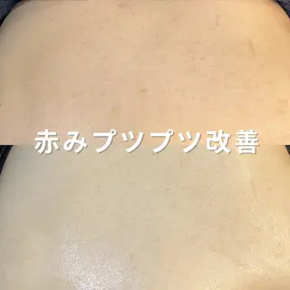 leolo武蔵浦和 肌質改善&脱毛のエステ・リラクイメージ