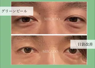 ハーブピーリング平井 駅徒歩3分のエステ・リラクイメージ