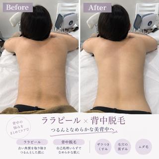 マツエク・マツパ 愛維美 肌質改善サロンのエステ・リラクイメージ