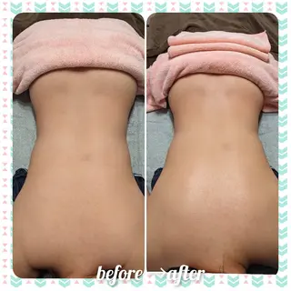 つくば／美姿勢カイロ トータルケア　のあんのエステ・リラクイメージ