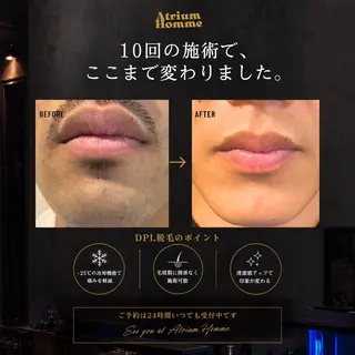 メンズ 恵比寿/アイブロウ/ 脱毛/Tatsuyaの眉毛・アイブロウイメージ