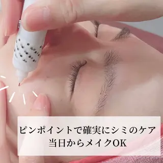 美肌シミケアサロン 4tune.RUMIのその他イメージ
