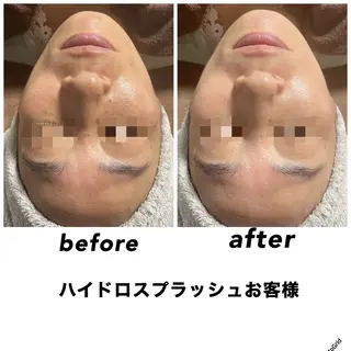 ネイル・エステサロン UILANIのエステ・リラクイメージ