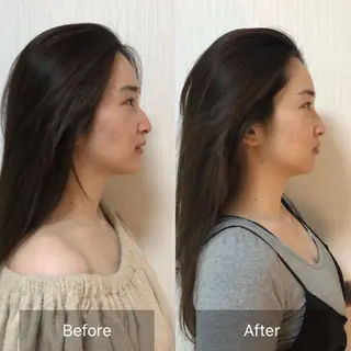 ミディアム カラー パーマ ヘアアレンジ メンズ マツエク・マツパ 温ヘッドマッサージ 【jiu】大久保佳奈のエステ・リラクイメージ