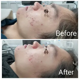 肌質改善Beauty salon Renのエステ・リラクイメージ