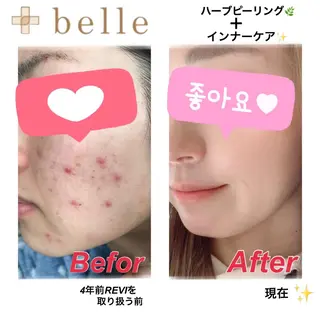 メンズ +belle プリュベルのエステ・リラクイメージ