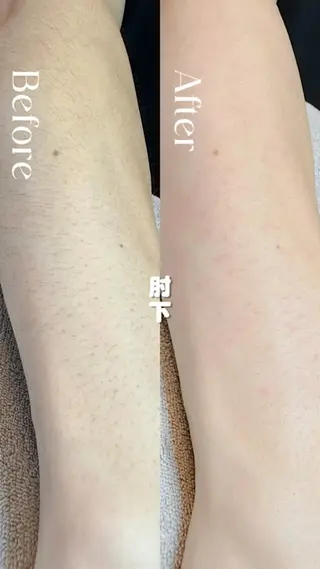 豊橋 |Hitomi シュガーリング専門店のその他イメージ