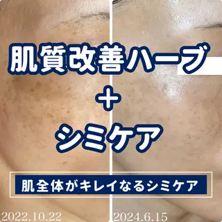 美肌シミケアサロン 4tune.RUMIのその他イメージ