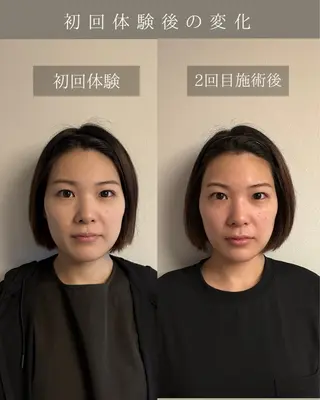 美肌&小顔矯正 Noelieのエステ・リラクイメージ