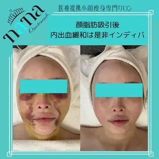 メンズ Nana銀座 高周波温熱専門サロンのエステ・リラクイメージ